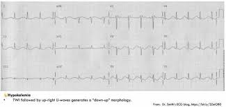 Image result for U Wave