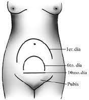 Entuertos Mpm