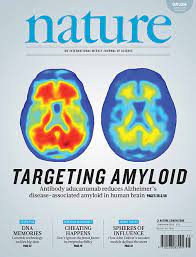 Aducanumab ist ein humaner monoklonaler antikörper; Rhode Island S Role In Promising New Alzheimer S Results Brown University
