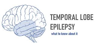 Image result for Temporal Lobe