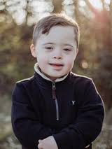 Airway Reconstruction for Floppy Airway: Mason's Story