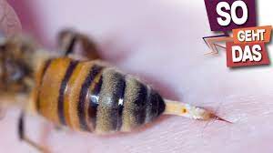 Wissen Bienen Dass Sie Sterben Wenn Sie Stechen Youtube