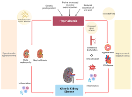 Image result for Hyperuricemia