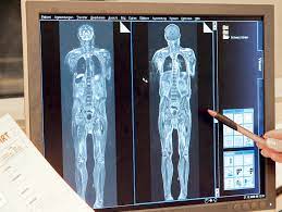 L'accueil des patients est réparti sur le service de radiologie de la polyclinique de blois, le cabinet de radiologie de la rue du. Radiologie Modernes Querschnittsfach