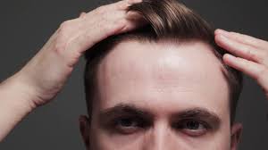 So before we look at our top 5 hairstyles for receding hairlines let's quickly highlight a couple of key issues articles like our 45 top hairstyles raise. This Guy Just Shared 5 Tips For Hiding A Receding Hairline