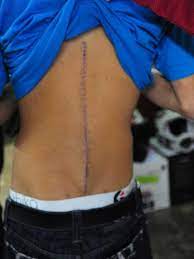 I was immediately drawn by the $10/month membership and the judgement free zone. Christian Craig 44 Moto Related Motocross Forums Message Boards Vital Mx