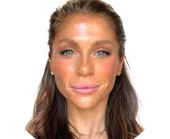 Specialism: Musculoskeletal