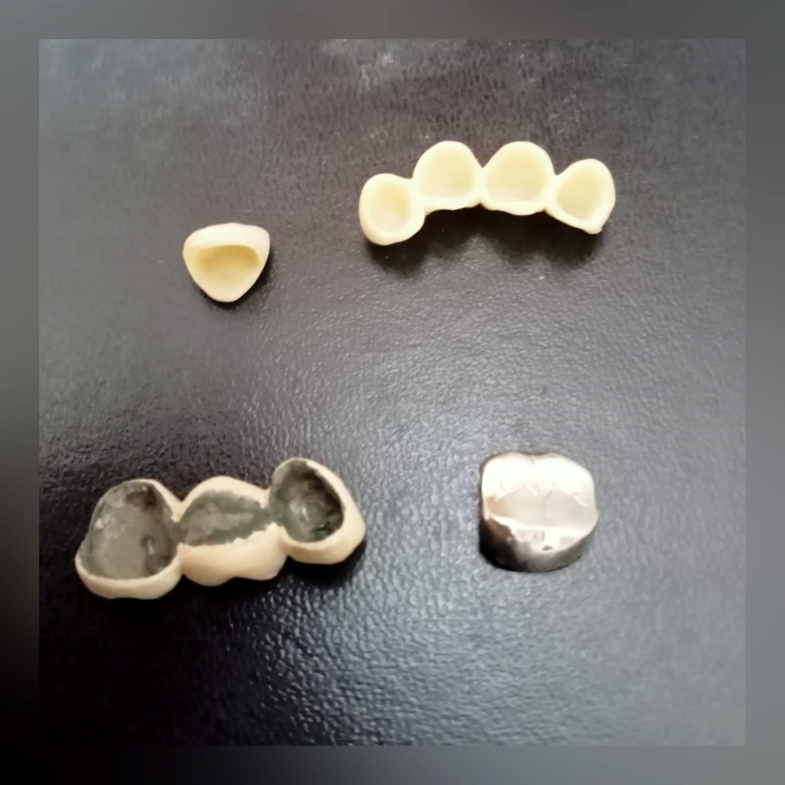 Fixed crowns/caps/bridges product image
