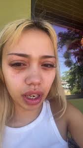 my allergies r so BAD its so NOT okay