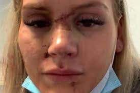 Wigan victim of horrific domestic abuse urges women to use Clare's Law to  probe partners' violent pasts