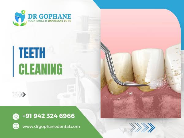 Teeth Cleaning In Yavatmal product image