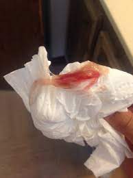 40 Weeks Lots Of Discharge With Blood After Cervix Checked Warning Pic Included Babycenter