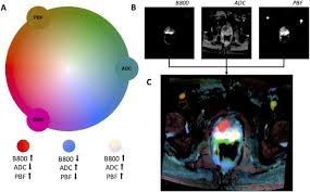 Cancer is a generic term for a large group of diseases that can affect any part of the body. Color Coded Visualization Of Magnetic Resonance Imaging Multiparametric Maps Scientific Reports