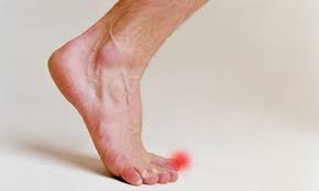 нарывает палец на ноге что делать в домашних условиях Chto Delat Esli Sluchilsya Ushib Palca Na Klinika Oberig Facebook