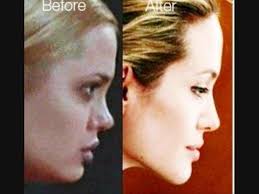 Good Plastic Surgery Angelina Jolie Before After Impressive Angelina Jolie Nose Job Angelina Jolie Plastic Surgery Angelina Jolie Nose