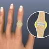 It typically results in warm, swollen, and painful joints. 1