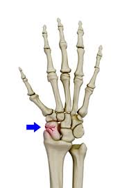 Image result for Scaphoid Bone