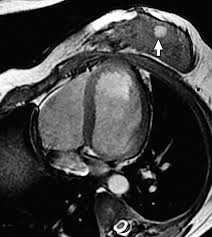 Image result for Incidental Imaging Finding