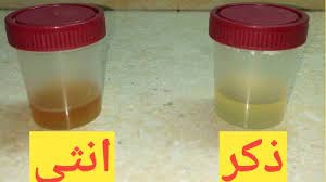 الفرق بين بول الحامل فى ولد وبول الحامل فى بنت youtube