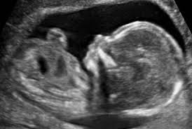 hafta hafta gebelik gelisimi 14 haftalik gebelik donemi canbebe blog