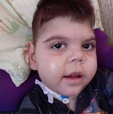 Mãe organiza bazar para conseguir leite para filho especial na RMC