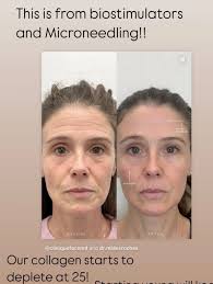 Clíodhna Hegarty RN (@aesthetic_nurse_cli) • Instagram photos and videos