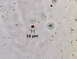Anatomy (bodily structure) given that they are eukaryotes, protozoa are larger cells of between 10 and 100 micrometer in diameter (compared to prokaryotes) with a more complex structure. Protozoa In Stool Stools Chairs