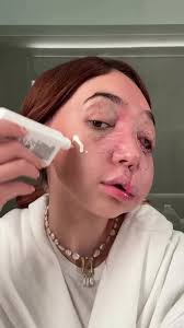 Carla Parte 2 Cambio Facial