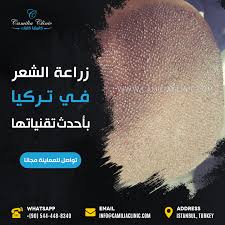 أفضل نتائج زراعة الشعر تركيا Incoming Call Screenshot Info