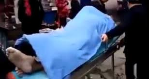 Talihsiz Adam Cinsel Iliski Esnasinda Oldu Ayrilamayan Cift Hastaneye Beraber Goturuldu Dailymotion Video