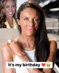 My husband said nobody will show me love because of my condition  😭❤️💔😭😭🙏🙏