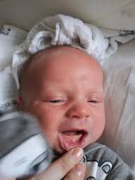 What are signs of tongue-tie in newborns?