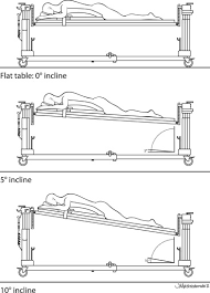 Proper trendelenburg positioning can minimize patient injury. Effect Of The Degree Of Reverse Trendelenburg Position On Intraocular Pressure During Prone Spine Surgery A Randomized Controlled Trial The Spine Journal