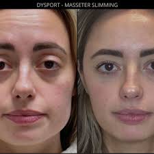 TOP 10 BEST Electrolysis Hair Removal near Needham, MA