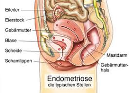 Schmerzen Starke Oder Ausbleibende Periode Diagnose Und Behandlung