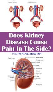Pin On Kidney Disease Diet