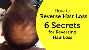 Before you start using supplements, topicals and oils to stop hair loss. How To Reverse Hair Loss 6 Secrets For Reversing Hair Loss Youtube