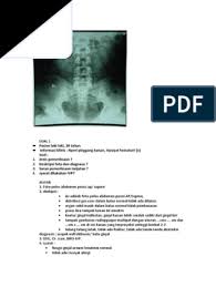 Maybe you would like to learn more about one of these? Kumpulan Soal Radiologi Masnurul