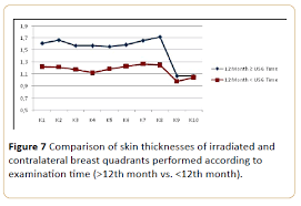The breast anatomy of males and females is slightly different. Evaluation With High Resolution Ultrasonography Of Skin Toxicity Due To Radiotherapy In Patients With Breast Cancer Insight Medical Publishing