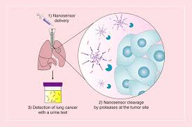 Coughing up lots of sputum, which may be bloody. New Sensors Could Offer Early Detection Of Lung Tumors Mit News Massachusetts Institute Of Technology