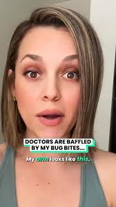 Something is alive inside of my arm... 😳