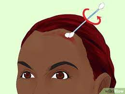 5 Easy Ways To Remove Hair Dye From Your Scalp Wikihow
