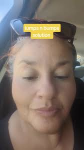 #lumps #bumps #cyst #boils #cancer #vegan #diet # healthyliving