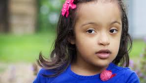 Down Syndrome Association