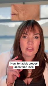 How to tackle crepey accordion lines effectively #accordionlines  #antiageing #ageingwell #skintok #skincarecommunity #antiageing  #40sskincare #40something