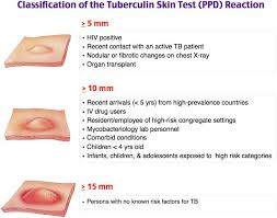 The tuberculosis skin test (also known as the tuberculin or ppd test) determines whether a person has developed an immune response to the bacterium that causes tuberculosis (tb). Rosh Review Medical Laboratory Science Nclex Medical Memes