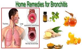 Natural remedies for bronchitis - Philadelphia Holistic Clinic ...