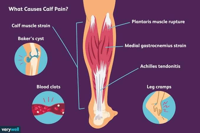 Leg Pain product image