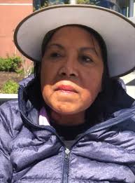 Kaiser VP Corwin Harper Claims Kaiser Didn't Require Sick Nurse to Work  While in Wheelchair