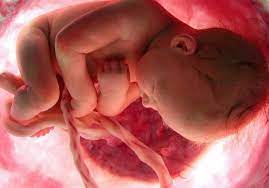 Jadi mommies kena alert lebih sikit ye masa pregnant. Bayi Kurang Bergerak Jangan Tunggu Esok Lusa Jumpa Doktor Lagi Lambat Lagi Bahaya Pa Ma